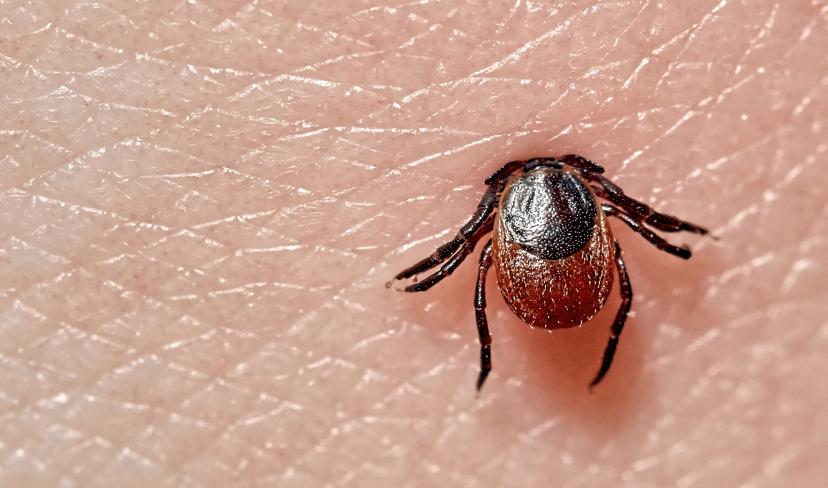 Tick Bites or Lyme Disease Treatment and Prescription PC Health